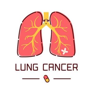 300x300 Alternative Treatment For Lung Cancer