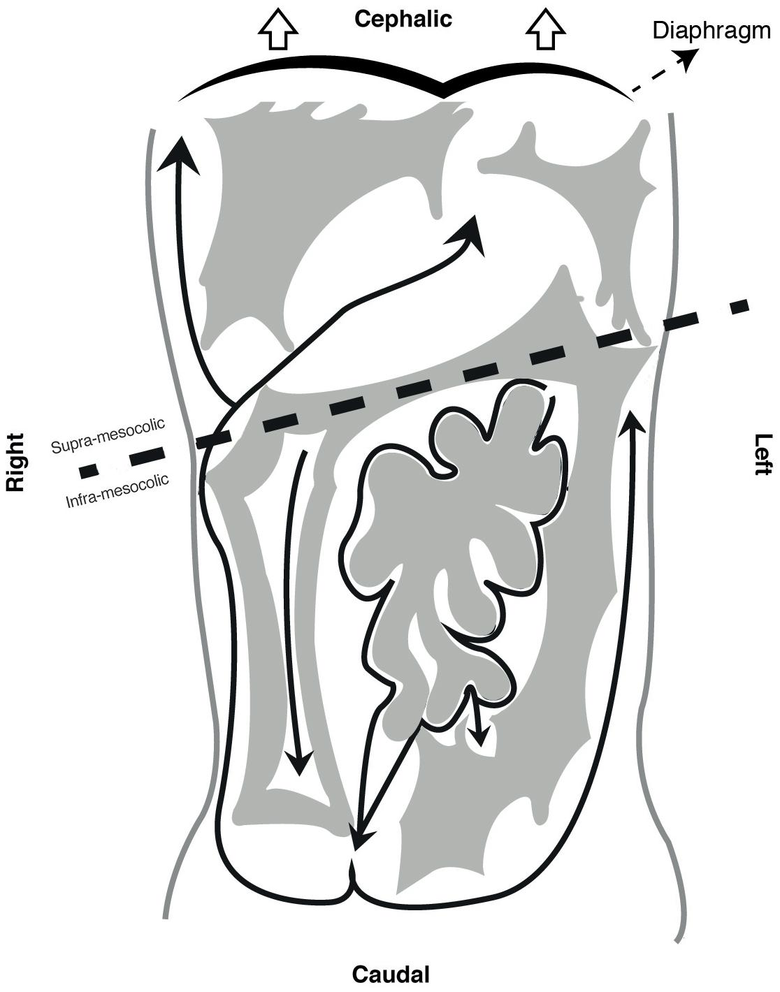 1116x1420 frontiers the peritoneum beyond the tissue a review physiology