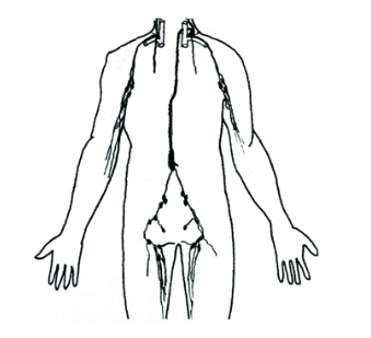 339x309 lymphatic system and histology questions and study guide quizlet