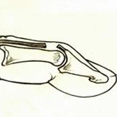 400x400 Mallet Finger Injury The British Society For Surgery Of The Hand