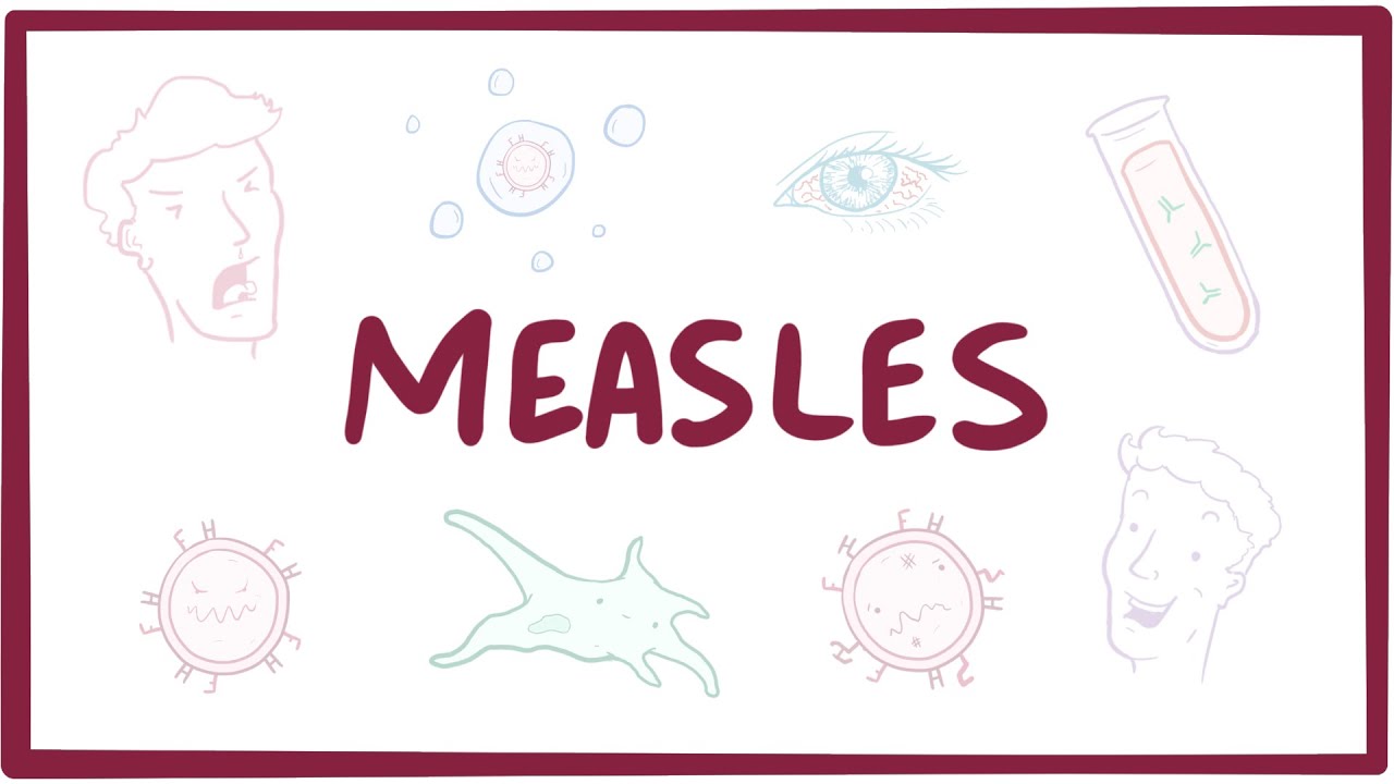 1280x720 measles