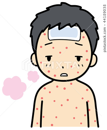 370x450 measles