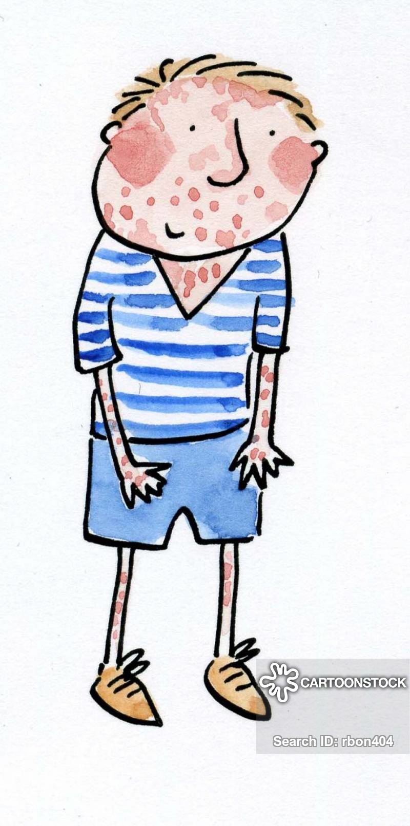 800x1609 measles cartoons and comics