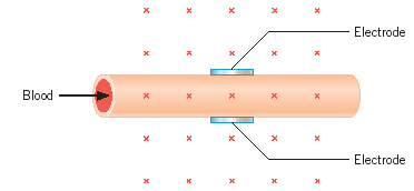 372x172 Solved The Drawing Shows A Type Of Flow Meter That Can Be