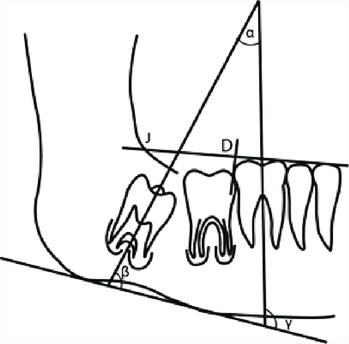 699x688 A Schematic Drawing Of The Angulations Of First And Third Molars