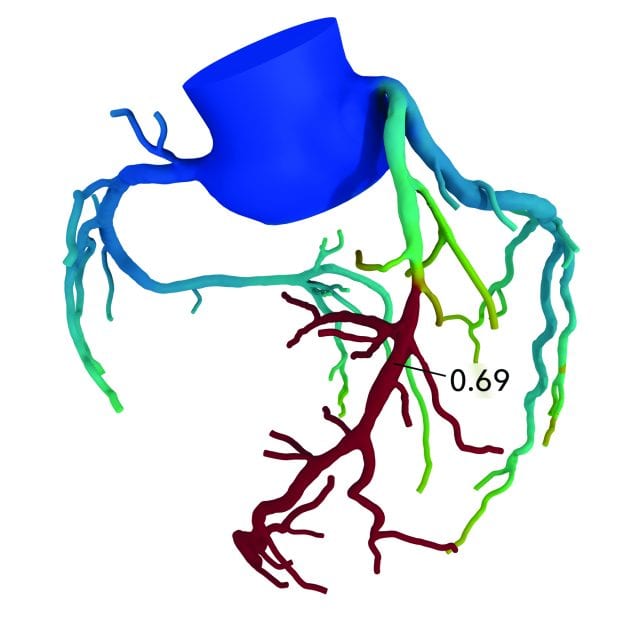 640x640 hackensack university medical center imaging and radiology adopts