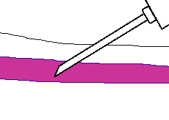 244x174 Blood Specimen Collection And Processing