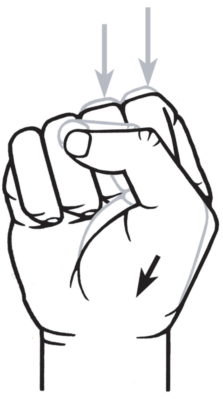 714x1280 in vitro strain in human metacarpal bones during striking testing