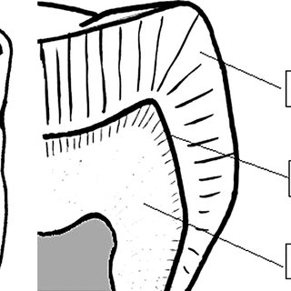 320x320 Schematic Drawing Of Molar Cut