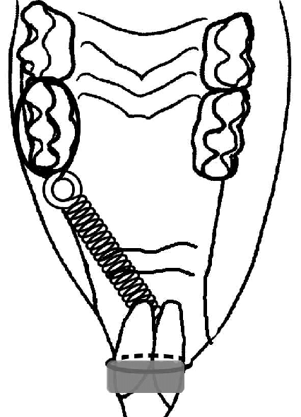 426x590 schematic drawing of an appliance for tooth movement download
