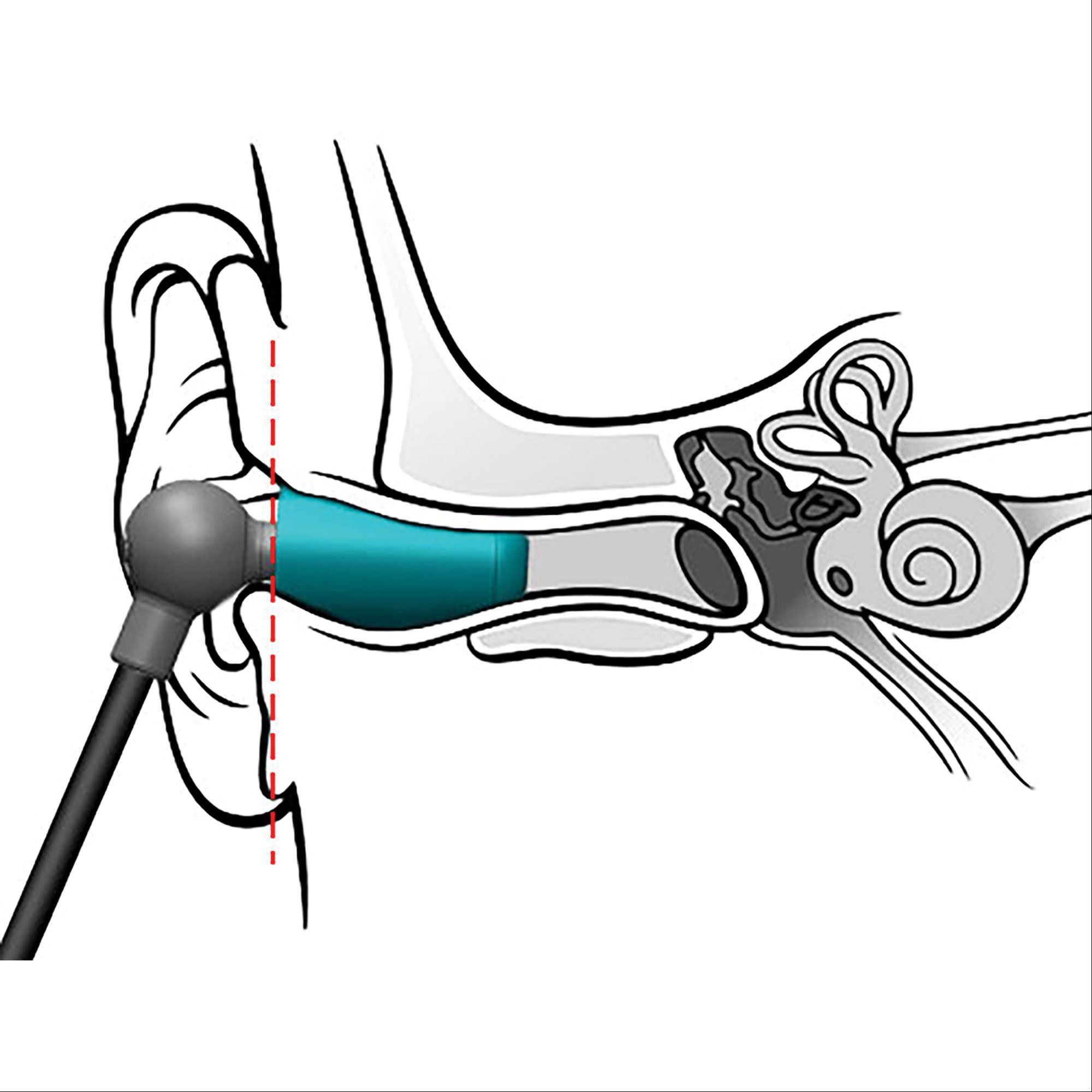 2000x2000 Mri Headphones And Ear Tips