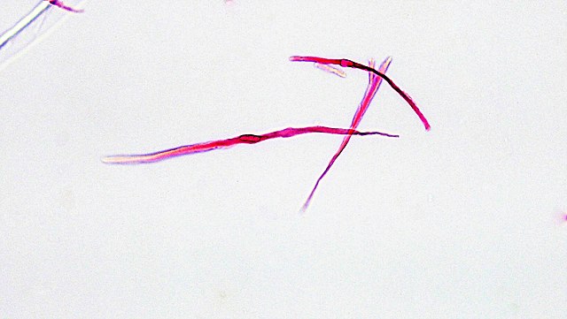 640x361 Filemuscle Tissue Teased Smooth