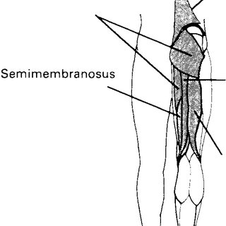 320x320 Muscles Instrumented With Electrodes In The V A Cwru Quadriplegic