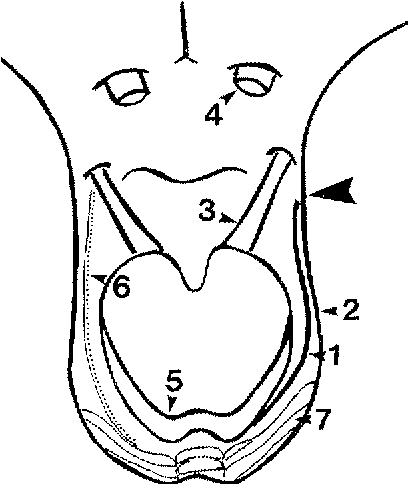 408x484 figure from the trochlear nerve anatomy