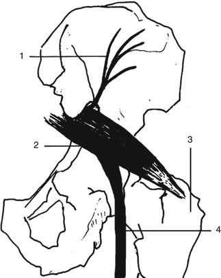323x405 Peripheral Nerve Entrapment Syndromes Of The Lower Extremity