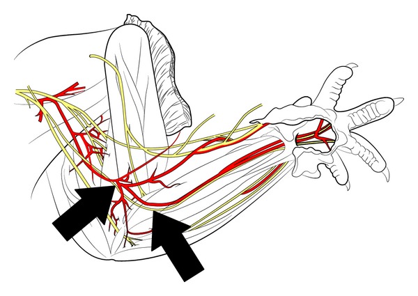 600x425 Schematic Drawing Of The Rat's Peripheral Nerves In The Upper