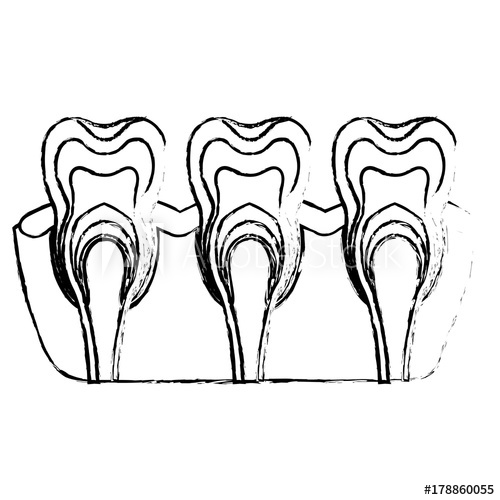 500x500 Teeth With Nerve And Tooth Root View In Monochrome Blurred