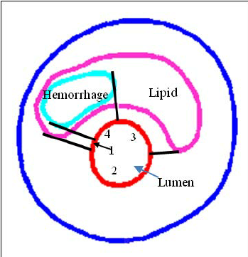349x361 schematic drawing demonstrating the node type assignment method