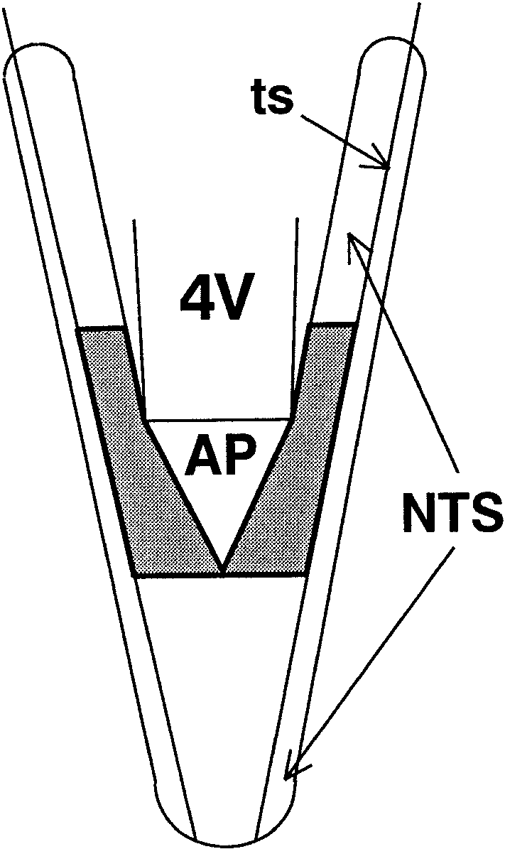 711x1195 Schematic Drawing Showing Portion Of The Nucleus Of The Solitary