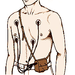 250x250 Dhs Mobile Pacemaker Check And Holter Monitoring Services In New