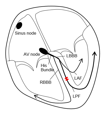 421x444 ecg university