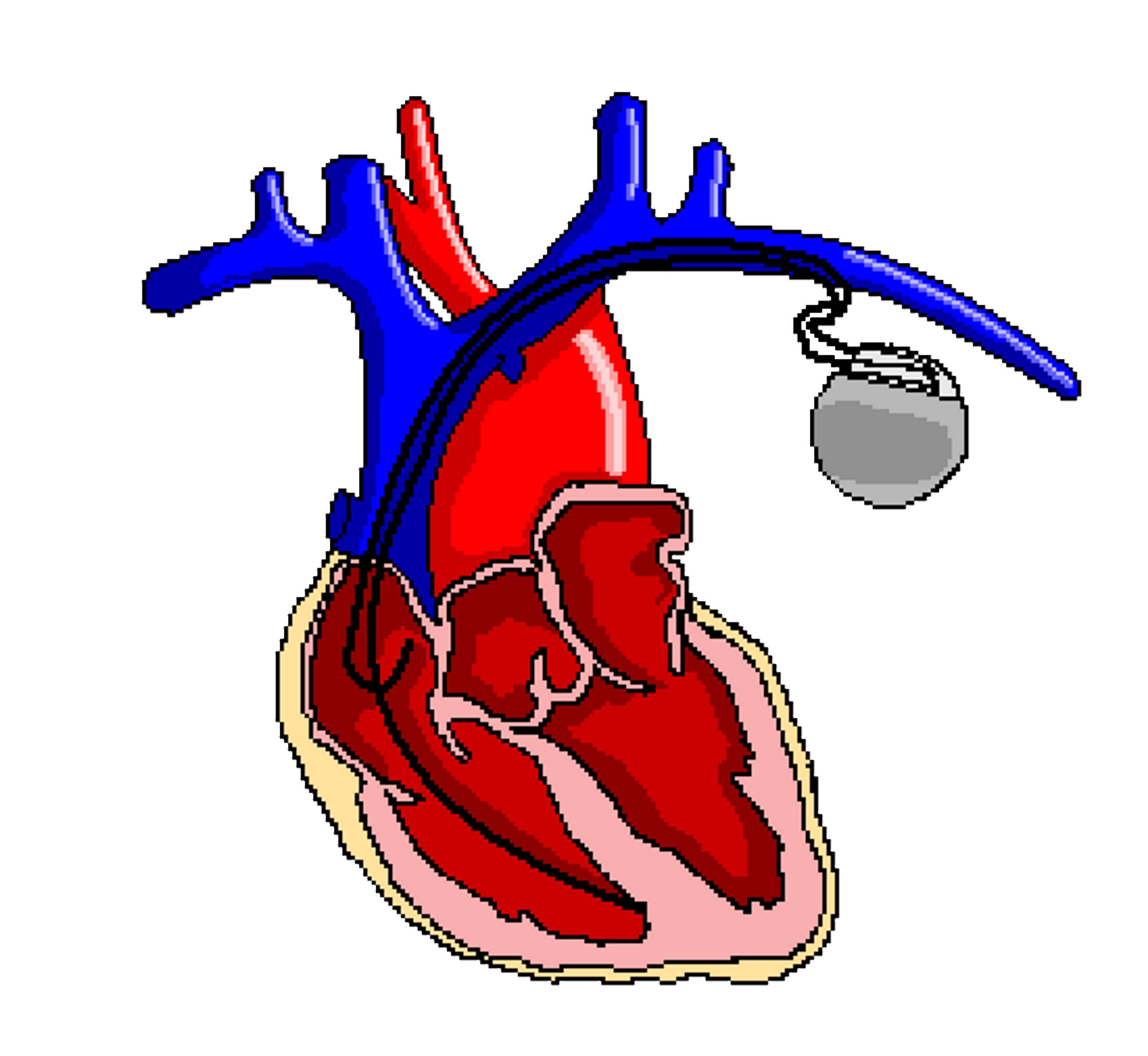 3300x3036 Pacemaker Components The Student Physiologist