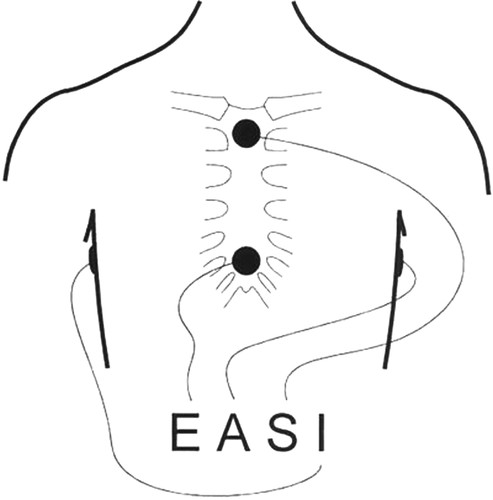 493x500 Practice Standards For Electrocardiographic Monitoring In Hospital