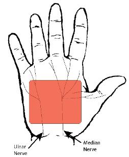 253x308 Qwi Solution For Hand Pa Numbness