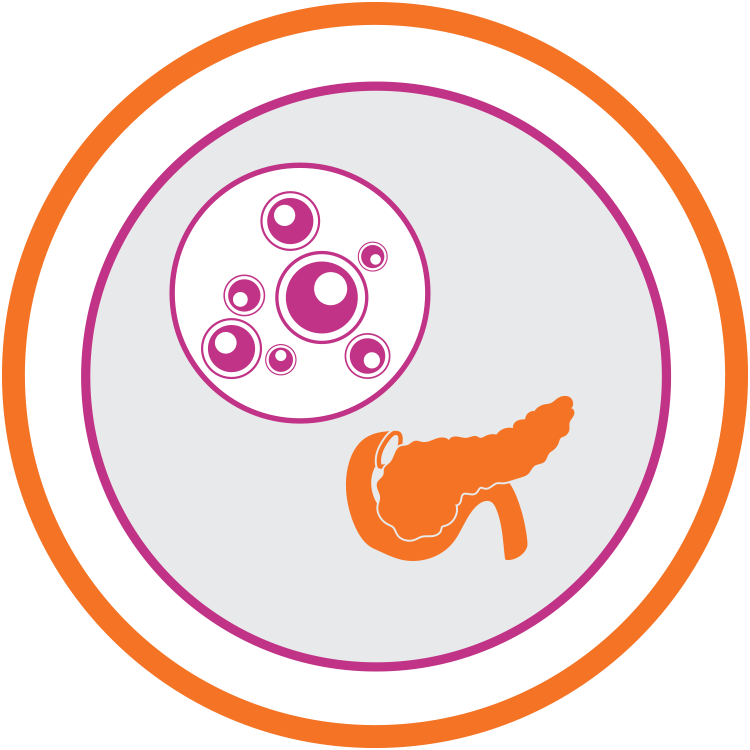 750x750 Islets Transplant