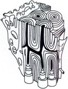 238x308 example of drawing taken directly from a diskette of medical clip