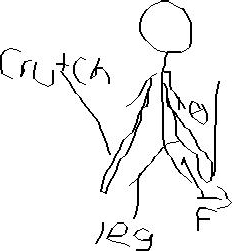 232x251 solved the person in the drawing is standing on crutches