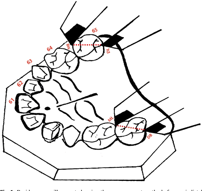 696x658 Identifying Sexual Dimorphism In A Paediatric South Indian