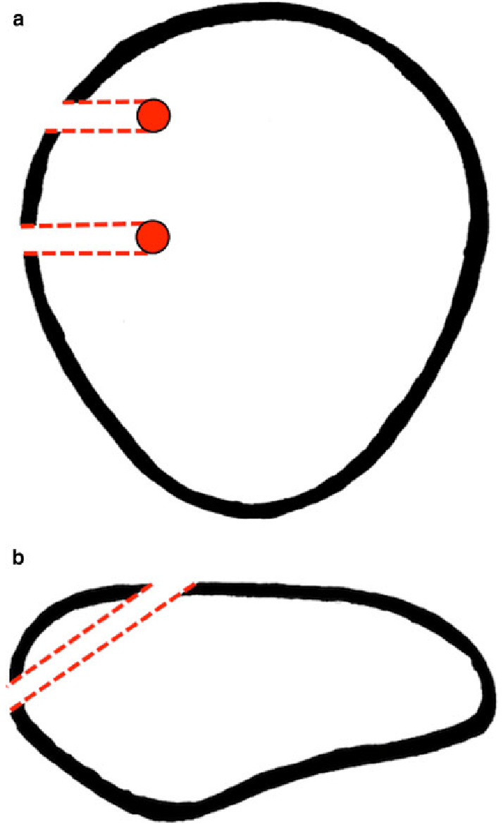 714x1186 Schematic Drawing Of The Position And Course Of The Patellar