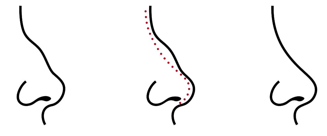 1056x441 Collection Of Free Drawing Nose Position Download On Ui Ex