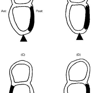 320x320 Drawings Of D Later Primitive Streak Mouse Embryos To Show