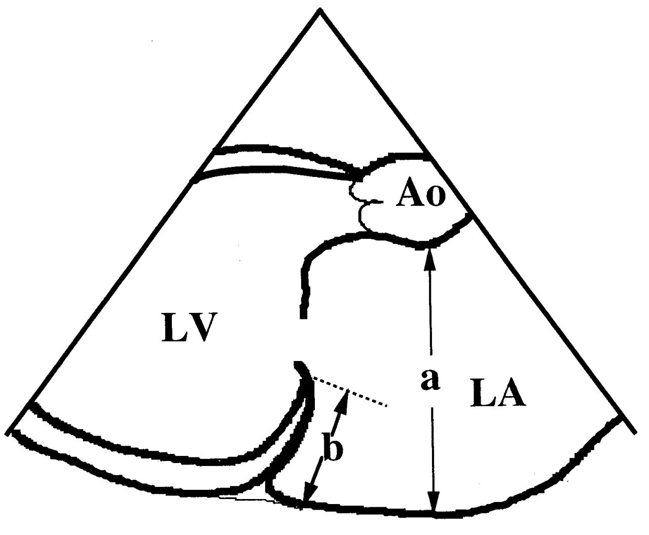 1280x1055 Fig Comparative Efficacy Of The Maze Procedure