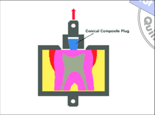 537x399 Left Schematic Drawing Of The Push Out Test Download