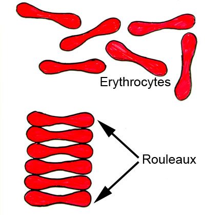 400x419 Erythrocyte Sedimentation Rate