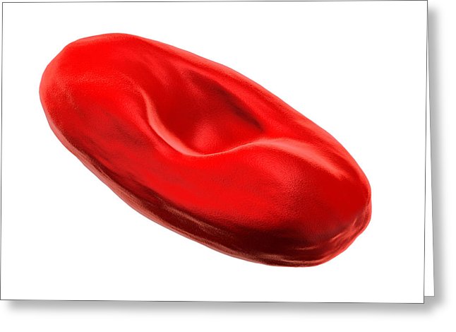 646x470 Abnormal Red Blood Cell Photograph