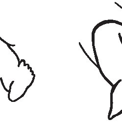 249x249 line drawing of ortolani's reduction maneuver download