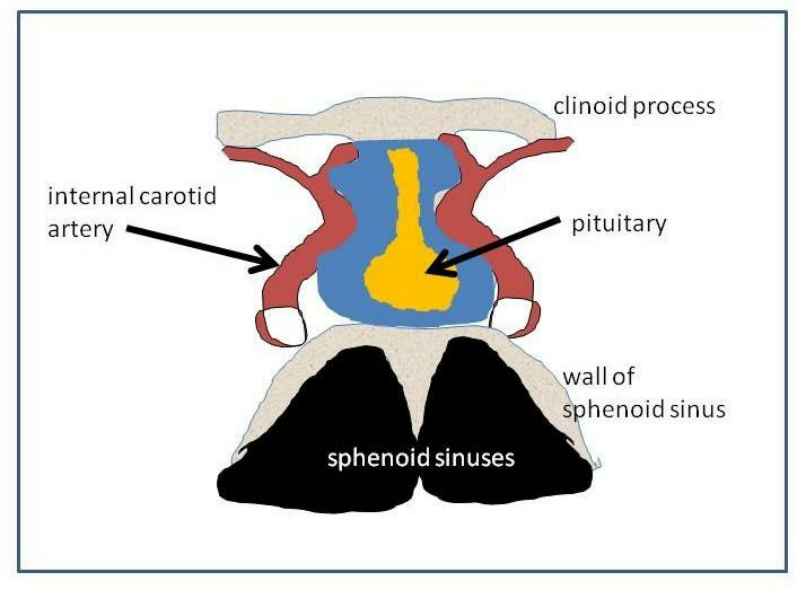 805x589 Drawing Of Parasellar Region Showing Relationship Of Internal