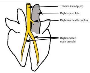 313x254 the essential defence of the respiratory tract