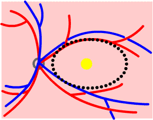 300x236 mechanism of diabetic retinopathy