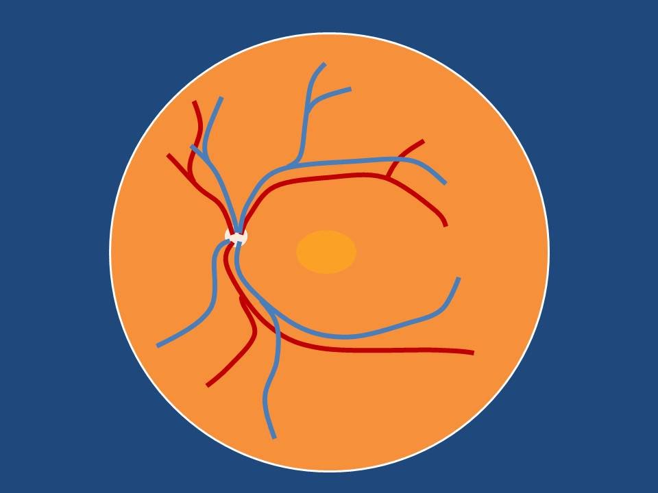 960x720 Other Changes
