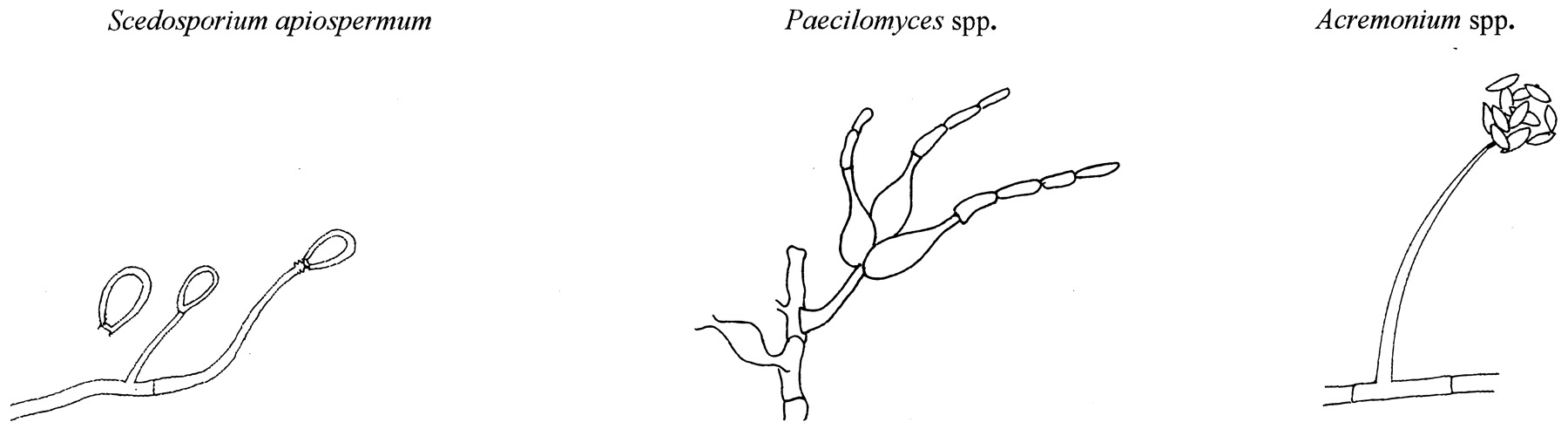 1800x492 Current Perspectives On Ophthalmic Mycoses Clinical Microbiology