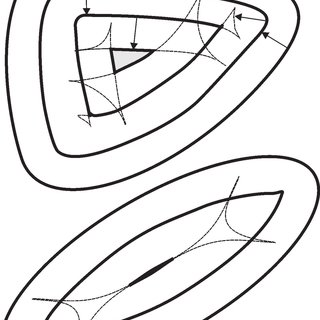 320x320 Typical Outcomes Of Contraction