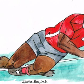 320x320 drawing shows the mechanism of posterior shoulder injury in rugby