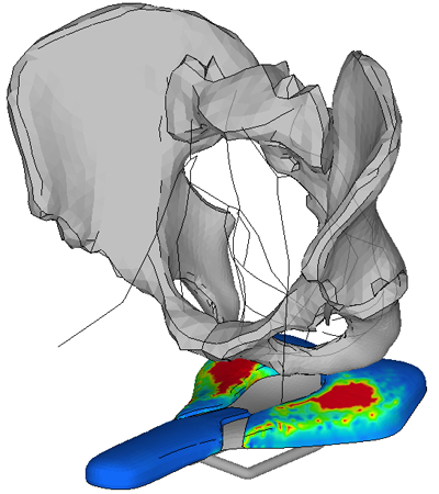 400x450 Pressure Measurement Saddle Sqlab Online Shop