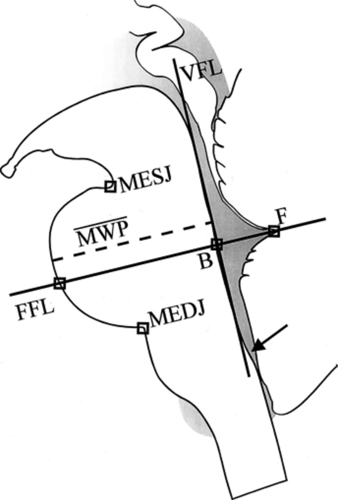 692x1024 A Brainstem Stereotactic Atlas In A Three Dimensional Magnetic