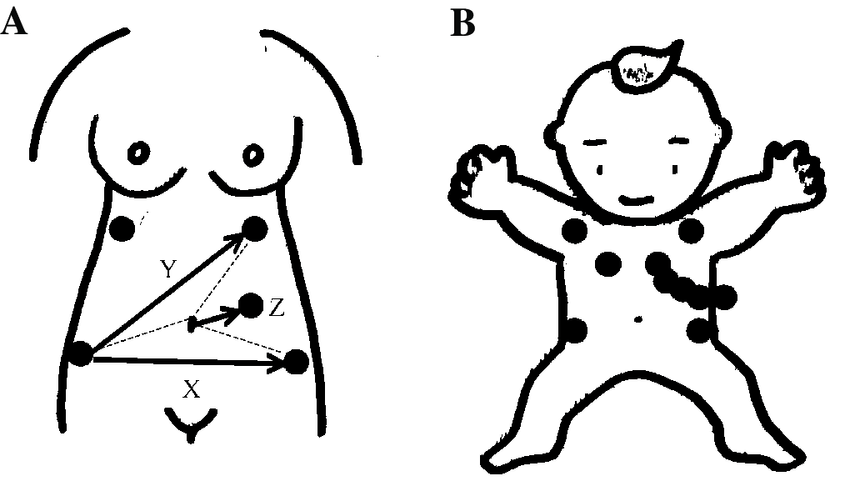 850x486 a measurement method of a fetal ecg